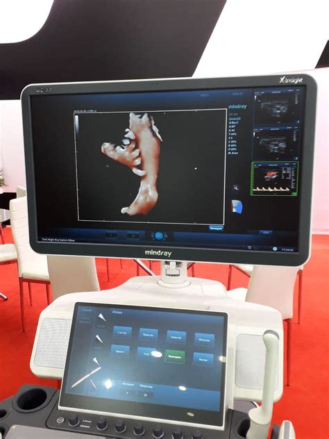Новинки Mindray: портативные УЗИ-аппараты ME-7, ИВЛ и эндоскопические ...