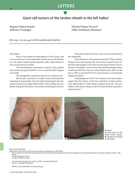 Pdf Giant Cell Tumors Of The Tendon Sheath In The Left Hallux