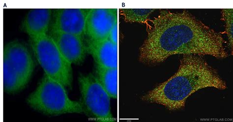 Confocal Fluorescence Microscopy