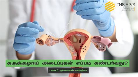 கருக்குழாய் அடைப்புகளை கண்டறிவது எப்படி Dr Rukkayal Fathima The