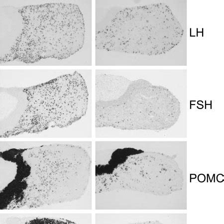 Mrna Expression Of Pituitary Hormones Of Pax And Wild Type Mice At