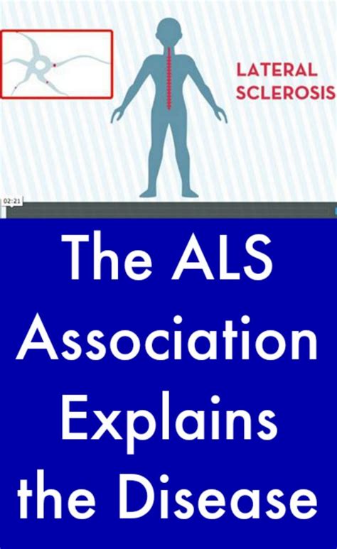 The Als Association Explains The Disease Als News Today Lou Gehrigs