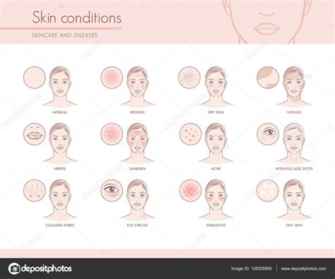 Skin conditions and problems Stock Vector Image by ©elenabs #128205900