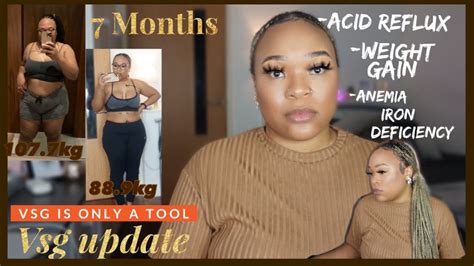 7 MONTHS POST OP VSG UPDATE ANAEMIC IRON DEFICIENCY WEIGHT GAIN