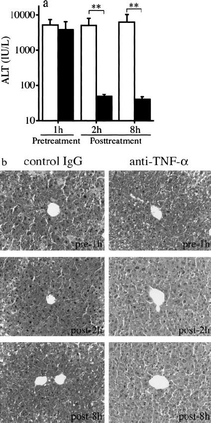 Gene Expression For Cytokines Chemokines And Adhesion Molecules In