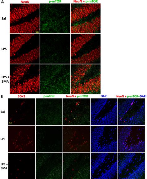 The Phospho P Mtor Signal Was Primarily In Hippocampal Neurons And