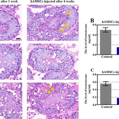 Human Amnion Mesenchymal Stem Cells Hamscs Restored Spermatogenesis