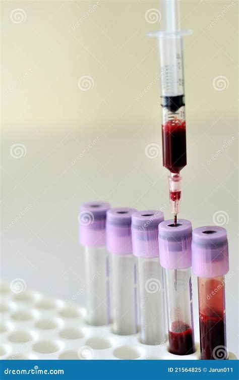 Muestra de sangre imagen de archivo. Imagen de laboratorio - 21564825