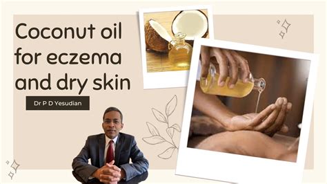 Virgin Coconut Oil For Eczema And Dry Skin Youtube