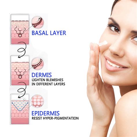 Buy Dark Spot Corrector, Dark Spot Remover - Improves Hyperpigmentation