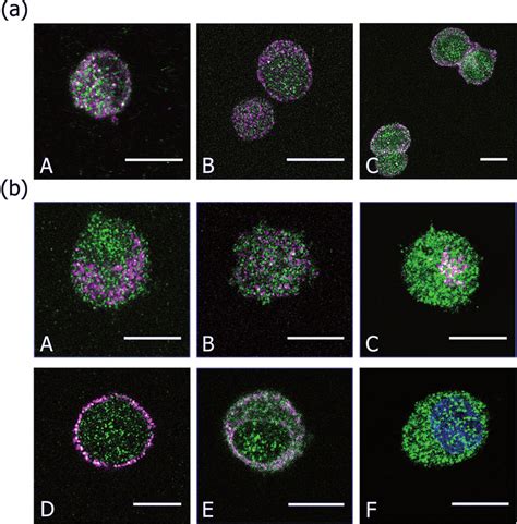 Distribution Of Myosin VI In PC12 Cells A Partial Colocalization Of