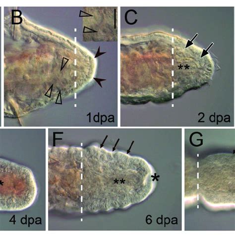 Posterior Regeneration In The Juvenile Oligochaete Tubifex Tubifex Download Scientific Diagram