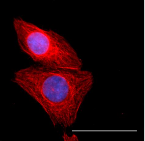 purified anti  tubulin recombinant antibody  tubulin qaa
