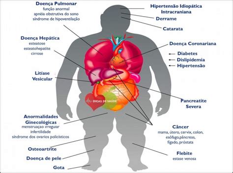 As 5 Principais Doenças Causadas Pela Obesidade Dicas De Saúde