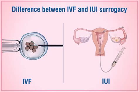 How To Prepare Your Body For IVF Treatment Sudha Fertility Centre