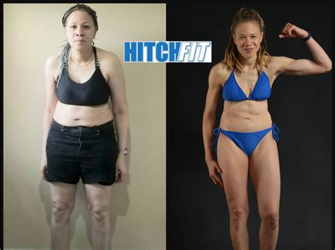 Jaw Dropping Transformation With Autoimmune Condition