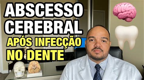 Julio Pereira Neurocirurgião SP on Twitter INFECÇÃO NOS DENTES