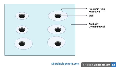 Radial Immunodiffusion Principle Procedure Result Uses Biology