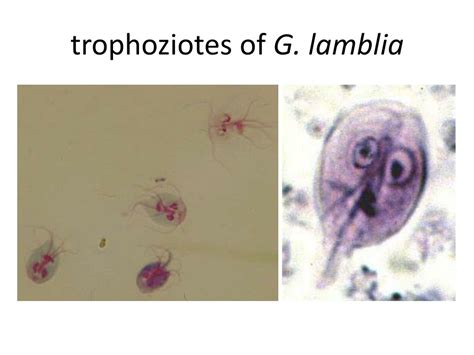 Ppt Giardia Lamblia Aka Giardia Intestinalis Or Giardia Duodenalis Powerpoint Presentation