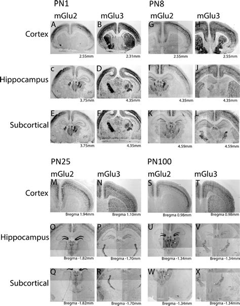 MGlu2 And MGlu3 MRNA Expression Throughout Development In Situ