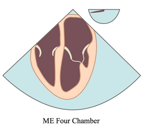 Mid Esophageal Four Chamber View