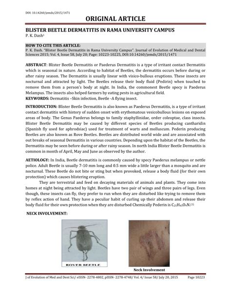 (PDF) BLISTER BEETLE DERMATITIS IN RAMA UNIVERSITY CAMPUS