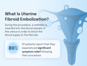 Uterine Fibroid Embolization Hysterectomy Alternatives