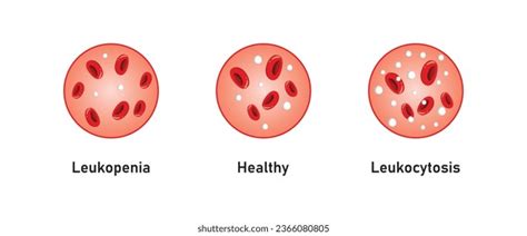 Neutropenia Icon Images Stock Photos And Vectors Shutterstock