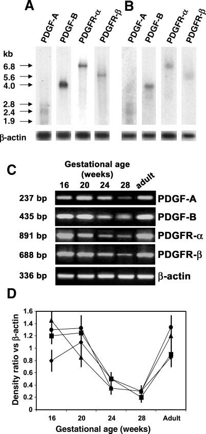 Northern Blot Analysis A And B And Rt Pcr C And D Of Pdgf And Pdgfr