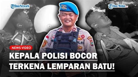 Detik Detik Kepala Polisi Bocor Terkena Lemparan Batu Saat Chaos Di