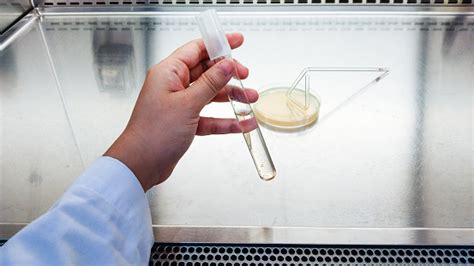 실험실에서 항생제를 검사하기 위한 페트리 접시클로즈업 샷 Bacteriologist에 대한 스톡 사진 및 기타 이미지