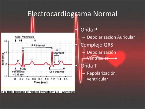 Electrocardiograma Normal Pptrrrrrrrrrrrrrrr PPT Descarga Gratuita