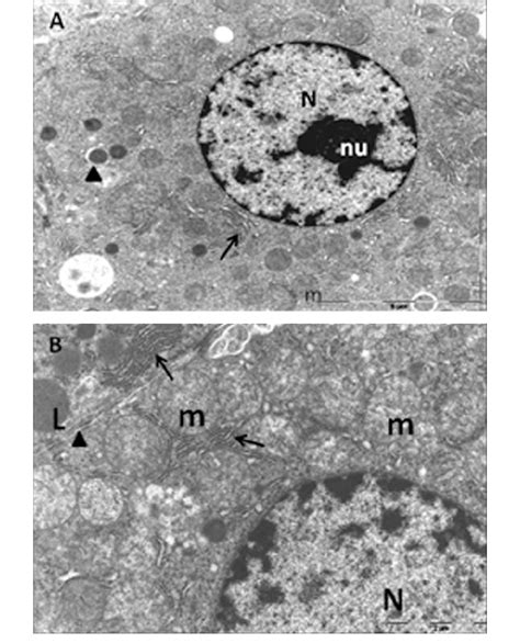 An Electron Micrograph Of Liver Of Control Rat A Showing Hepatocyte Download Scientific