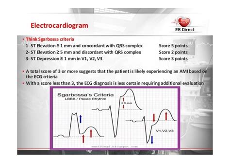 St Elevation Mi 2