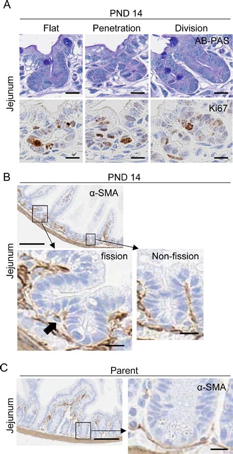 Figure 1 From Histopathological Evaluation Of Crypt Fission During