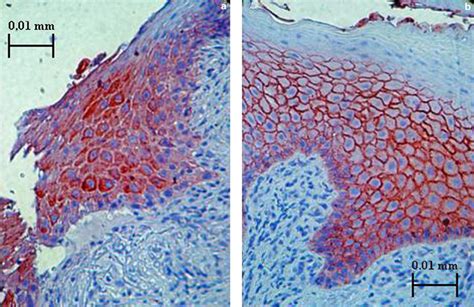 Expression Profile Of Eph Receptors And Ephrin Ligands In Human Skin