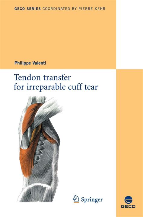 Infraspinatus Tendon Tear Tranetbiologiaufrjbr