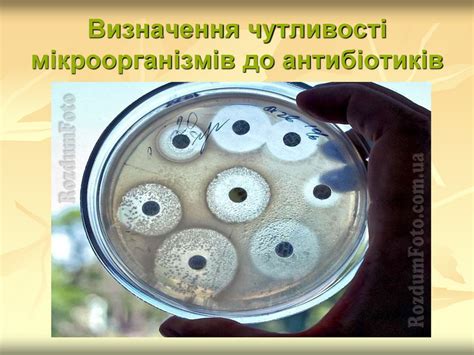 Вступ до мікробіології. Морфологія та фізіологія мікроорганізмів ...