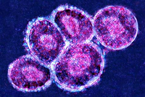 Gene editing embryonic stem cells might increase risk of cancer | New ...