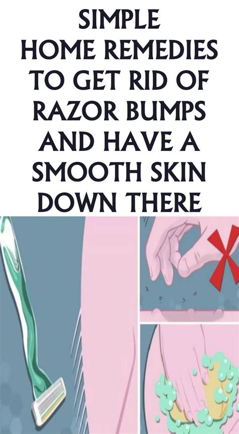 How To Heal Razor Burn On Face