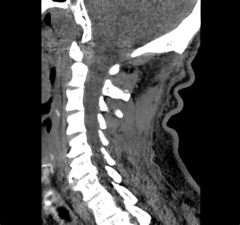 Radiology Category Differential Diagnosis Of