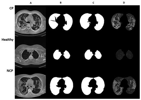 AI Free Full Text COVID 19 Diagnosis From Chest CT Scans A Weakly