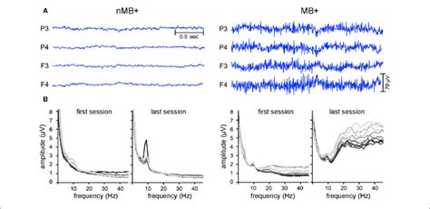 Examples Of The EEG Data With And Without The EMG Contamination A