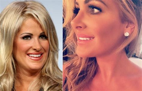 Kim Zolciak Biermann How real is she after Plastic surgery?