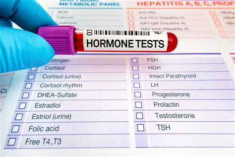 Hormonski Test Kako Se Radi Arz Hr