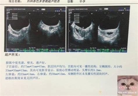 男孩還是女孩？醫生這些「暗語」會提醒胎兒性別，你聽懂了嗎？ 壹讀