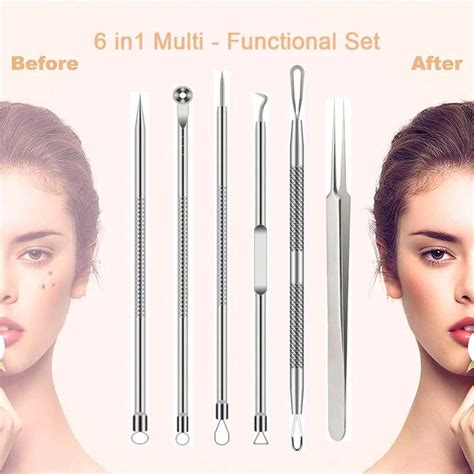 1Set Pimple Popper Tool Kit, Blackhead Remover Acne Needle Tools Set ...