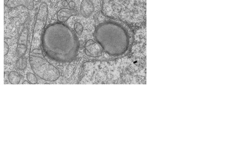 Electron Microscopy Visualizat [image] Eurekalert Science News Releases