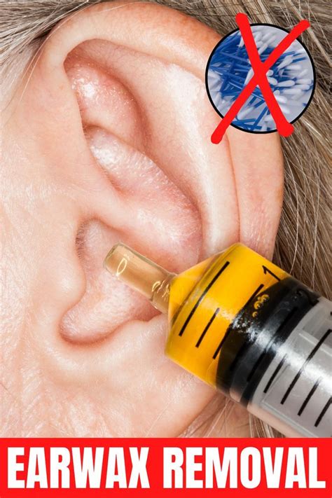 Earwax Removal How To Safely Remove It At Home Ear Cleaning Wax Ear