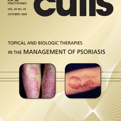 Topical And Biologic Therapies In The Management Of Psoriasis Mdedge